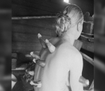 Terapi Bekam dengan Tanduk