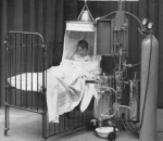 Alat Bantu Pernapasan di Zaman Dulu