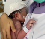 Qwenzy Mendapat Perawatan