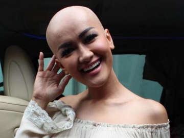 Kondisi Semakin Kritis, Adik Jupe: Mama Ikhlas