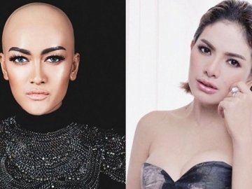 Polda Metro Jaya Datangi Jupe di Rumah Sakit. Ada Apa?