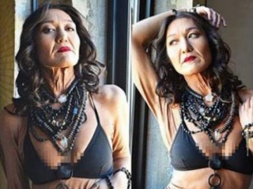 Tak Disangka, Model Wanita Berkulit Keriput Ini Ternyata Masih Berusia 26 Tahun