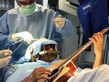 Pria di India Jalani Operasi Otak Sambil Main Gitar, Ini Alasannya ... 