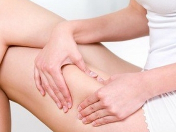 Tak Ingin Muncul Selulit di Tubuh? Ini 5 Cara Mencegahnya