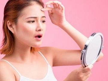 Letak Jerawat Ternyata Bisa Mendeteksi Kondisi Kesehatan Kita, Seperti Ini Misalnya