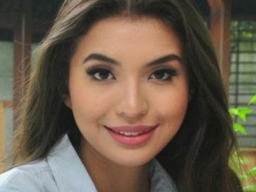 Manohara Pinot Unggah Foto Pamer Paha, Netizen: Kok Kurusan?