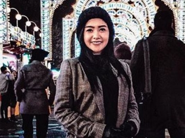 Akhirnya Perawatan Usai Dihina Akibat Ketiak Hitam, Cita Citata Masih Kena Nyinyir