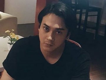 Mobil Ditabrak Truk Tronton, Dimas Andrean Alami Kerugian Hingga Puluhan Juta