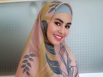 Lalai Lakukan Ini Saat Kemudikan Mobil, Kartika Putri Alami Kecelakaan