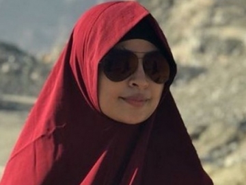 Posting Soal 'Sergai Berdarah', Bekas Luka di Pelipis Tantri Kotak Jadi Sorotan