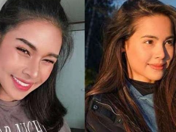 Transgender Asal Thailand Habiskan Uang Demi Oplas Secantik Superstar, Begini Hasilnya