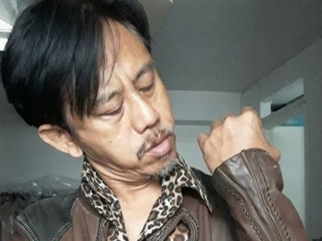 Didiagnosa Derita Glukoma Pada Mata Kirinya, Epy Kusnandar Segera Jalani Operasi
