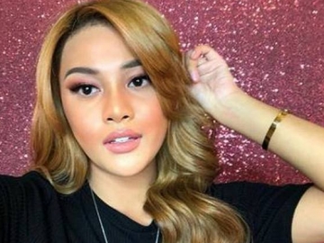 Aurel Hermansyah Pamer Warna Rambut Baru, Netter: Itu Ketombean?