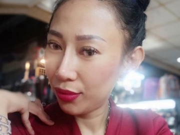 Dewi Sanca Sempat Pamer Luka Bekas Cakaran di Tangan & Kakinya, Ternyata Ini Penyebabnya