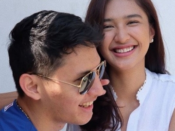 Salah Satu Pose Mesranya Bareng Pacar Dipotong, Mikha Tambayong Takut Dibully?