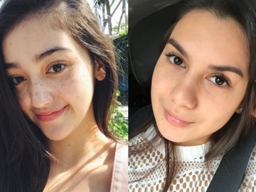 Tak Perlu Ribet Ikuti Tren Makeup, 8 Seleb Indonesia Ini Sudah Cantik dengan Freckles Alami