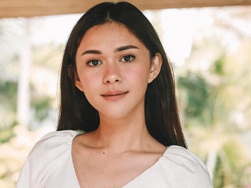 Alami Skin Shaming, Nana Mirdad Beri 'Tamparan' Halus