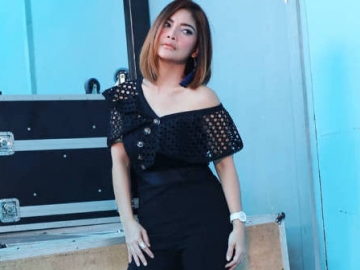 Tak Banyak yang Tahu, Ternyata Wajah Irma Darmawangsa Dipenuhi Bulu