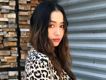 Dituding Berketombe, Adzana Bing Slamet Bungkam Netter Lewat Balasan Ini