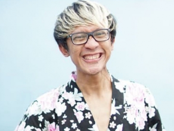 Unggah Foto Bibir Jontor, Aming: Habis Operasi Plastik Sedot WC