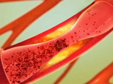 8 Bahan Alami yang Mampu Menurunkan dan Menstabilkan Kolesterol