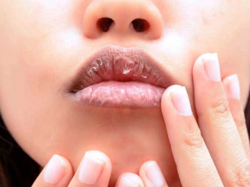 7 Bahan Alami yang Ampuh Melembapkan Bibir Kering dan Pecah-Pecah