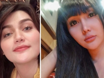 Billy Syahputra Sebut Lucinta Luna Mirip Hilda Vitria, Netter Tak Terima 