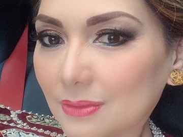 Kecelakaan Di Bojonegoro, Pipi Nia Daniati Terhantam Besi 