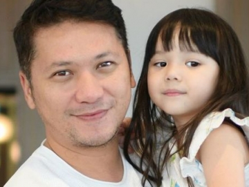  Gading Marten Jelaskan Alasan Mata Gempita Bisa Minus Silinder