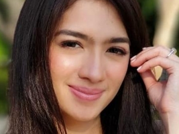  Angel Karamoy Panik Wajahnya Berjerawat