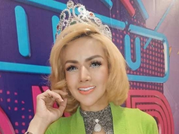 Bibir 'Jontor' Jadi Tren, Barbie Kumalasari Justru Makin Tuai Cibiran Hingga Disebut Pembohong
