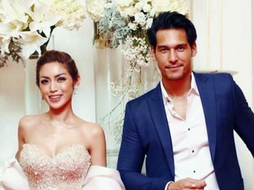 Jessica Iskandar Disebut Kelewat Kurus di Foto Cover Majalah Bareng Richard Kyle