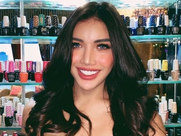 Sempat Akui Enggan Operasi Kelamin, Millendaru Kini Justru Cari Rumah Sakit Bagus