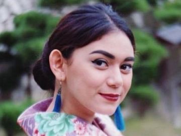 Lempar Senyuman, Thalita Latief Kabarkan Kondisi Terkini Setelah Operasi Pengangkatan Tumor 