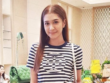 Mikha Tambayong Tampil Klasik Bak Idol K-Pop di Pemotretan Ini, Setuju?