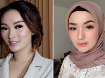 Mantan Suami Nikahi Zaskia Gotik, Imel Putri Ternyata Sempat 'Halu' Begini
