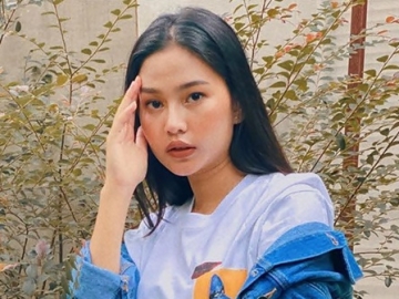 Dinyinyir Usai ‘Rombak’ Hidung, Selebgram Dara Arafah Sebut Kantongi Izin Orangtua Sejak SMP