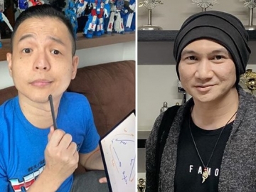 Ernest Prakasa 'Bedah' Ucapan Permintaan Maaf Anji dengan Sindiran Menohok