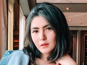 Angela Lee Peringatkan Agar Tak Sembarangan Pakai Tetes Mata, Akibatnya Ngeri