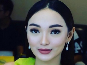  Kram Hingga Tak Bisa Jalan, Bagaimana Kandungan 4 Bulan Zaskia Gotik?