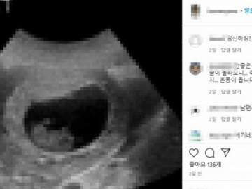 Mantan Member Gilrband Ini Diduga Hamil Usai Tidur dengan Banyak Pria yang Menjadi 'Sponsornya'