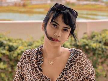 Didakwa Kepemilikan 20 Butir Xanax, Kuasa Hukum Beber Alasan Vanessa Angel Beli Obat di Surabaya