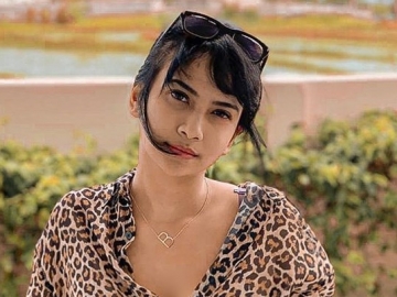 Bayi Vanessa Angel Alami Kelainan Tongue-tie, Disarankan untuk Segera Lakukan Ini