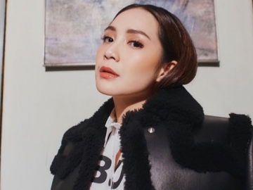 Nagita Slavina Jerawatan di Dahi Dibilang Tanda Hamil, Benarkah?