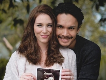 Elus Perut Sang Istri, Intip Cara Unik Randy Pangalila Umumkan Jenis Kelamin Calon Anak Pertama