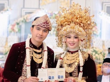 Buat Lagu untuk Nissa Sabyan Langsung Viral, Aldi Taher Bongkar Reaksi Protes Istri Pertama Kali