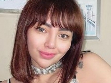 Nadia Christina Ogah Lapor Polisi Walau Jadi Korban KDRT Alfath Fathier