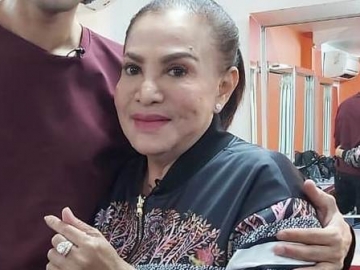 Angkat Silikon Wajah, Mpok Atiek Rela Dioperasi 21 Kali Lebih