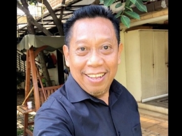  Usai Jalani Operasi Otak, Begini Kondisi Terakhir Tukul Arwana