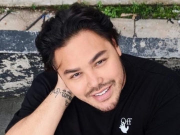 Ivan Gunawan Bakal Jalani Operasi Payudara